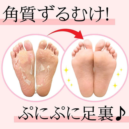 Bea’s Up Perorin Foot Peeling Pack, Enough for 2 Peels, Grapefruit - Usagi Shop