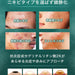 NILE Acne Care Cream - Usagi Shop